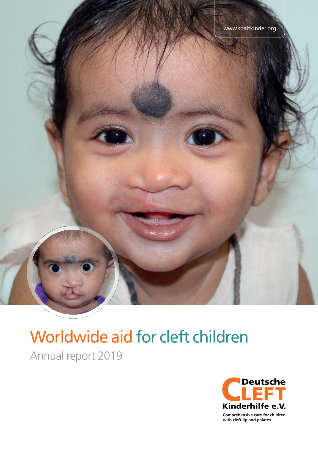 Worldwide Aid for Cleft Children Annual Report 2019