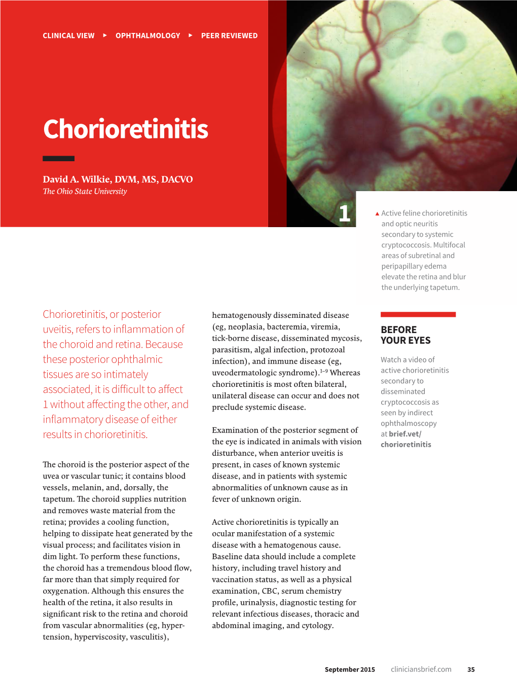Chorioretinitis