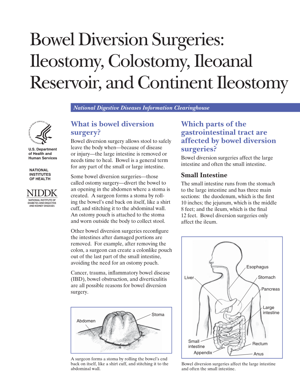 Bowel Diversion Surgeries: Ileostomy, Colostomy, Ileoanal Reservoir, and Continent Ileostomy