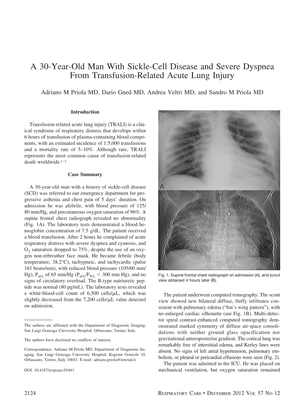 A 30-Year-Old Man with Sickle-Cell Disease and Severe Dyspnea from Transfusion-Related Acute Lung Injury