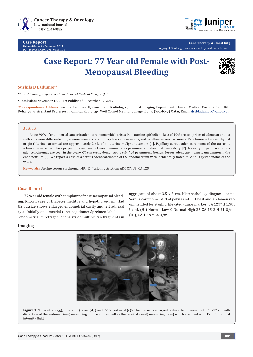 Case Report: 77 Year Old Female with Post-Menopausal Bleeding