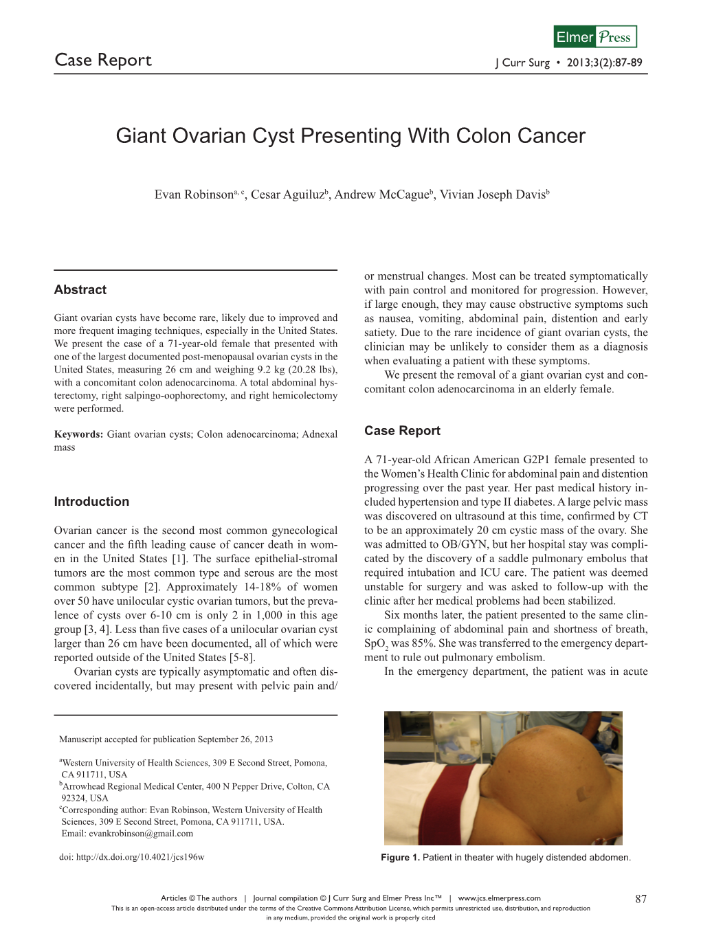 Giant Ovarian Cyst Presenting with Colon Cancer