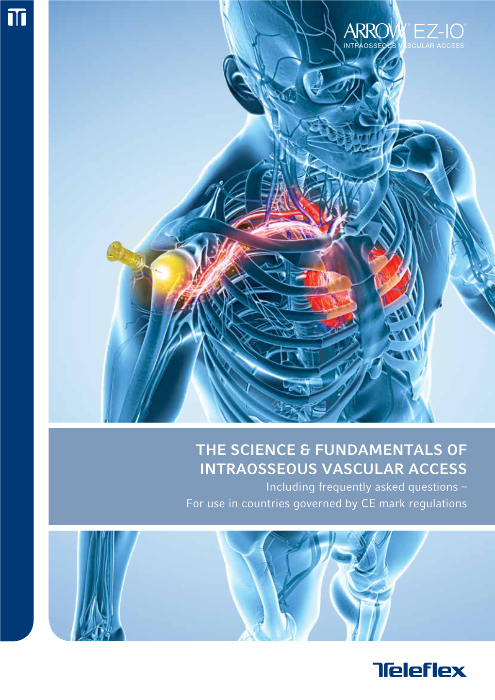 Teleflex Medical Paediatric Products the Science & Fundamentals of Intraosseous Vascular Access