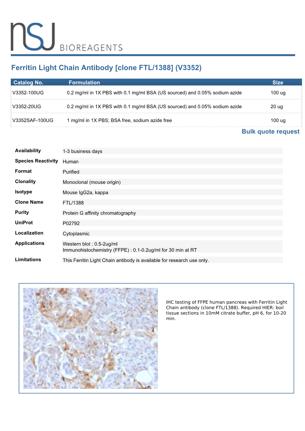 Ferritin Light Chain Antibody [Clone FTL/1388] (V3352)