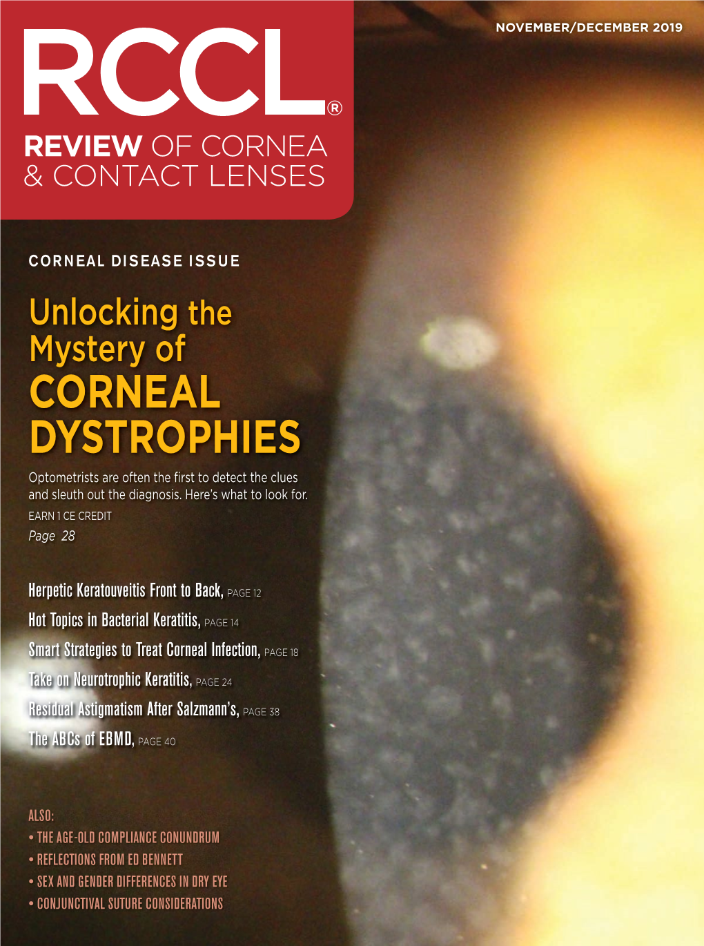 CORNEAL DYSTROPHIES Optometrists Are Often the ﬁ Rst to Detect the Clues and Sleuth out the Diagnosis