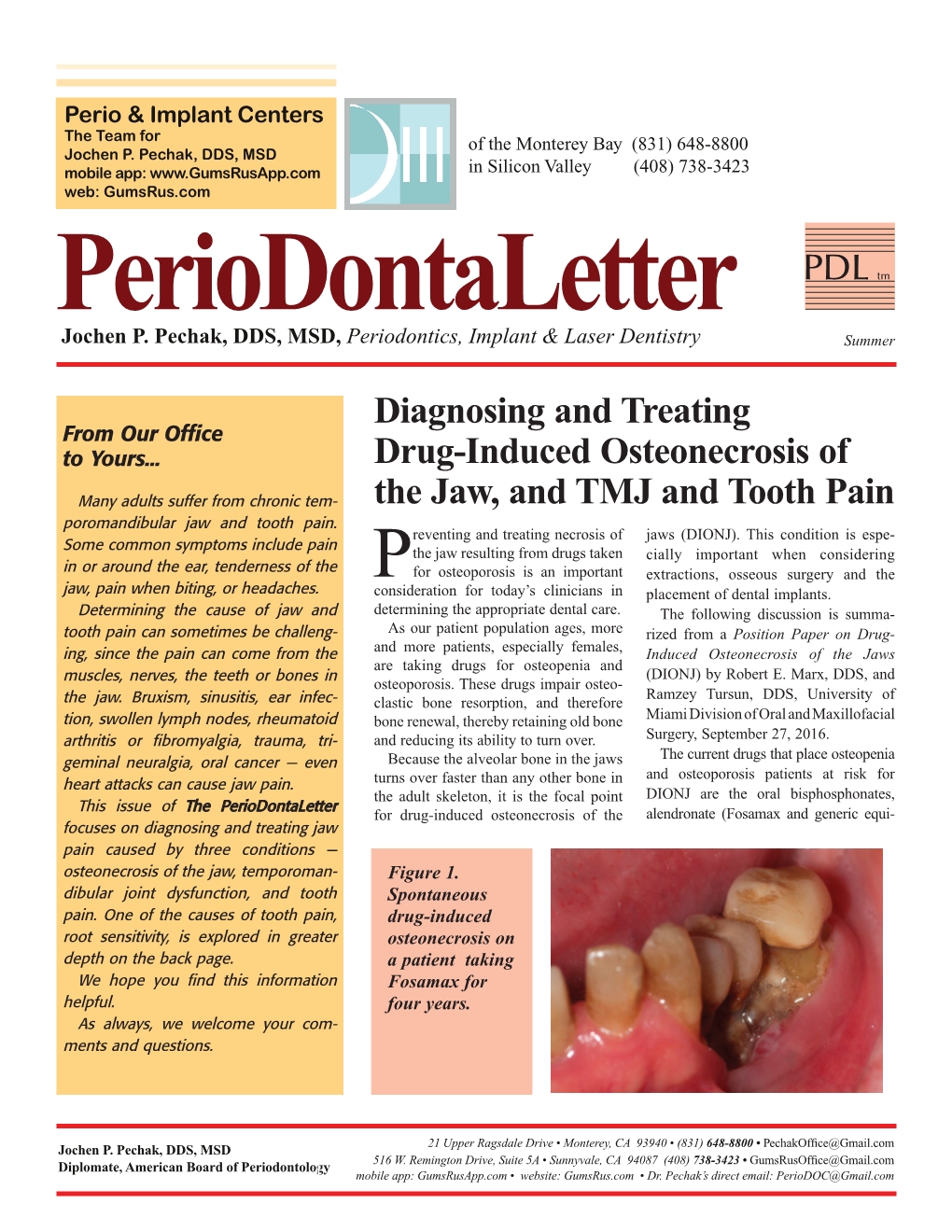 Diagnosing and Treating Drug-Induced Osteonecrosis of the Jaw, and TMJ and Tooth Pain