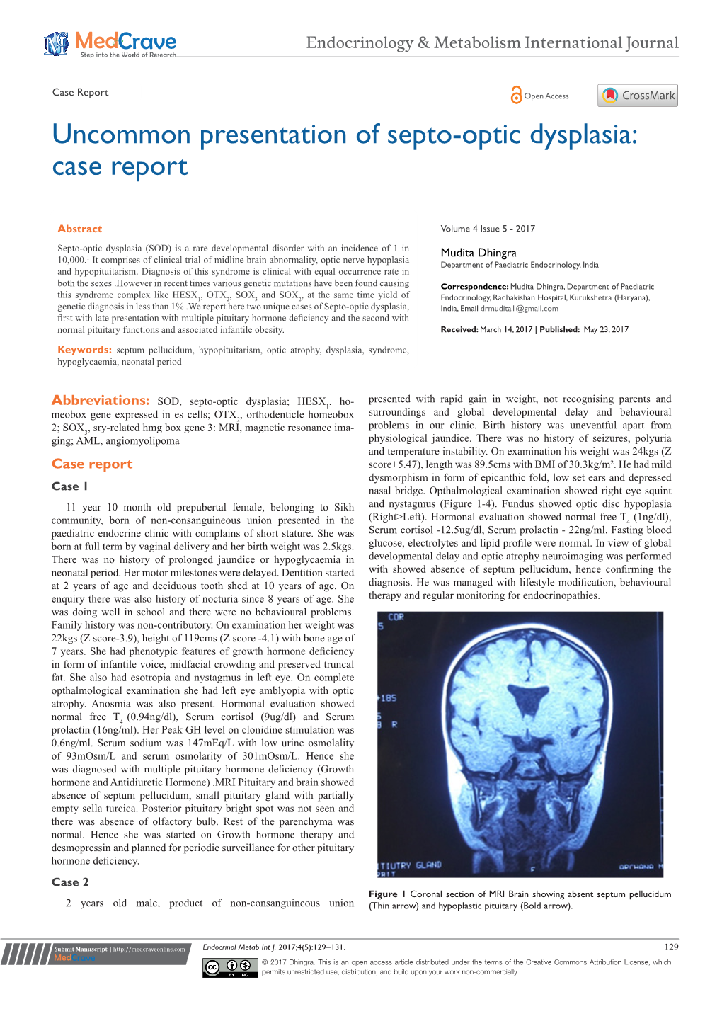 Uncommon Presentation of Septo-Optic Dysplasia: Case Report