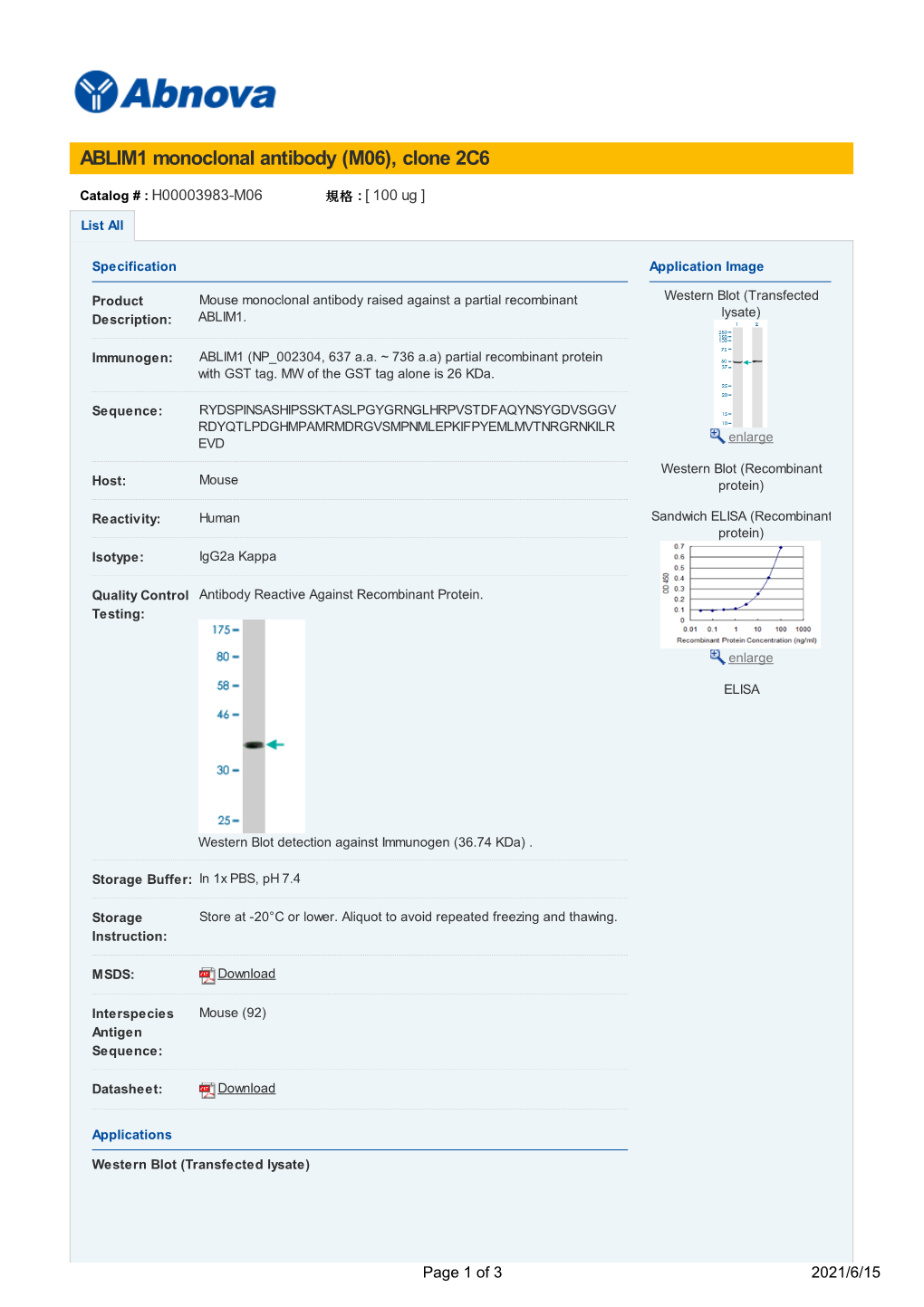 ABLIM1 Monoclonal Antibody (M06), Clone 2C6