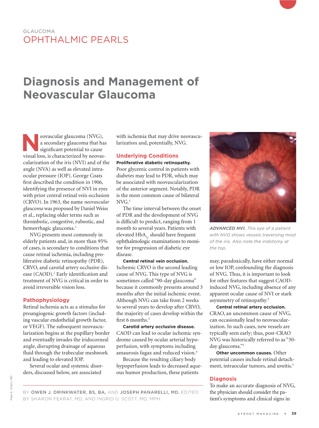 Diagnosis and Management of Neovascular Glaucoma