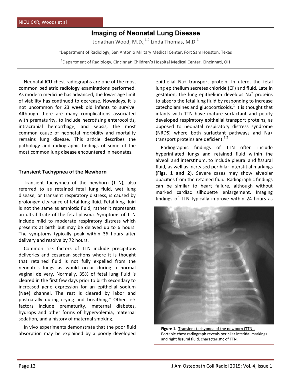 Imaging of Neonatal Lung Disease 1,2 1 Jonathan Wood, M.D., Linda Thomas, M.D