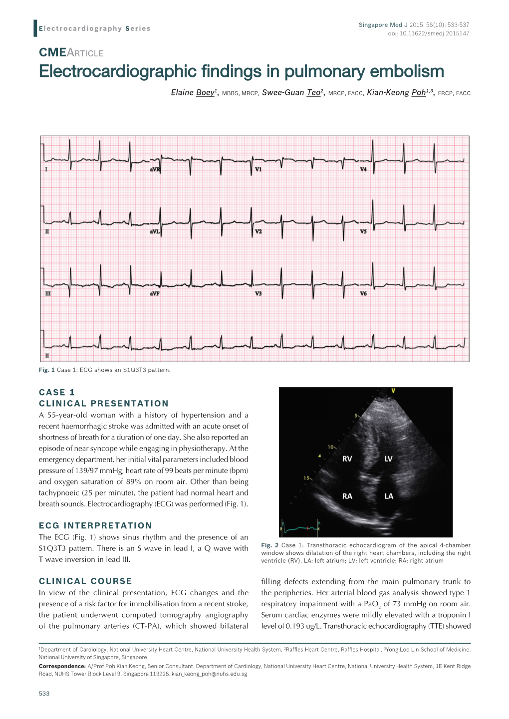 Electrocardiographic Findings in Pulmonary Embolism
