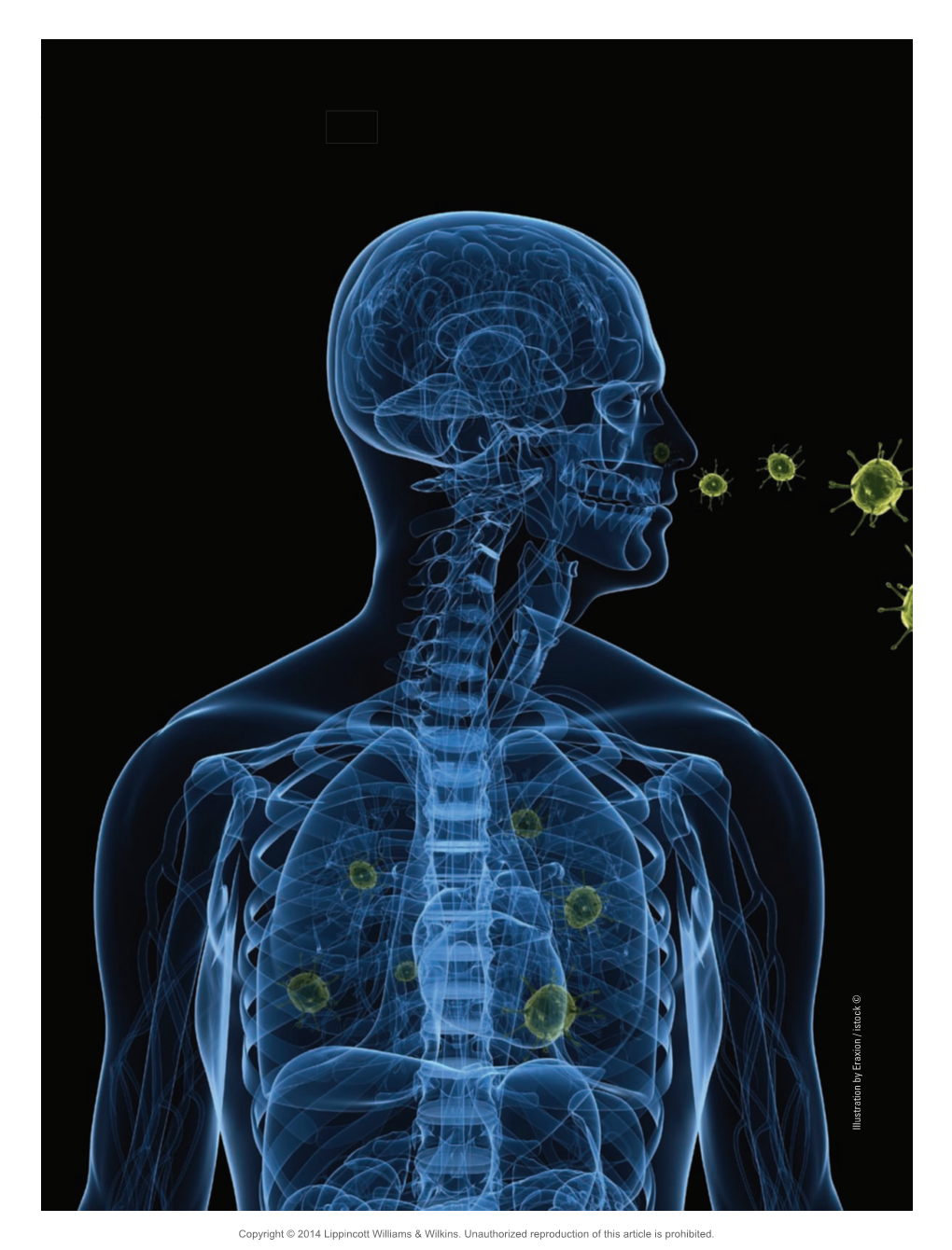 Evidence-Based Diagnosis and Management of Acute Bronchitis Illustration by Eraxion / Istock ©