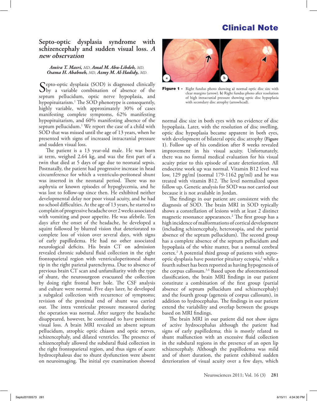 Septo-Optic Dysplasia Syndrome with Schizencephaly and Sudden Visual Loss