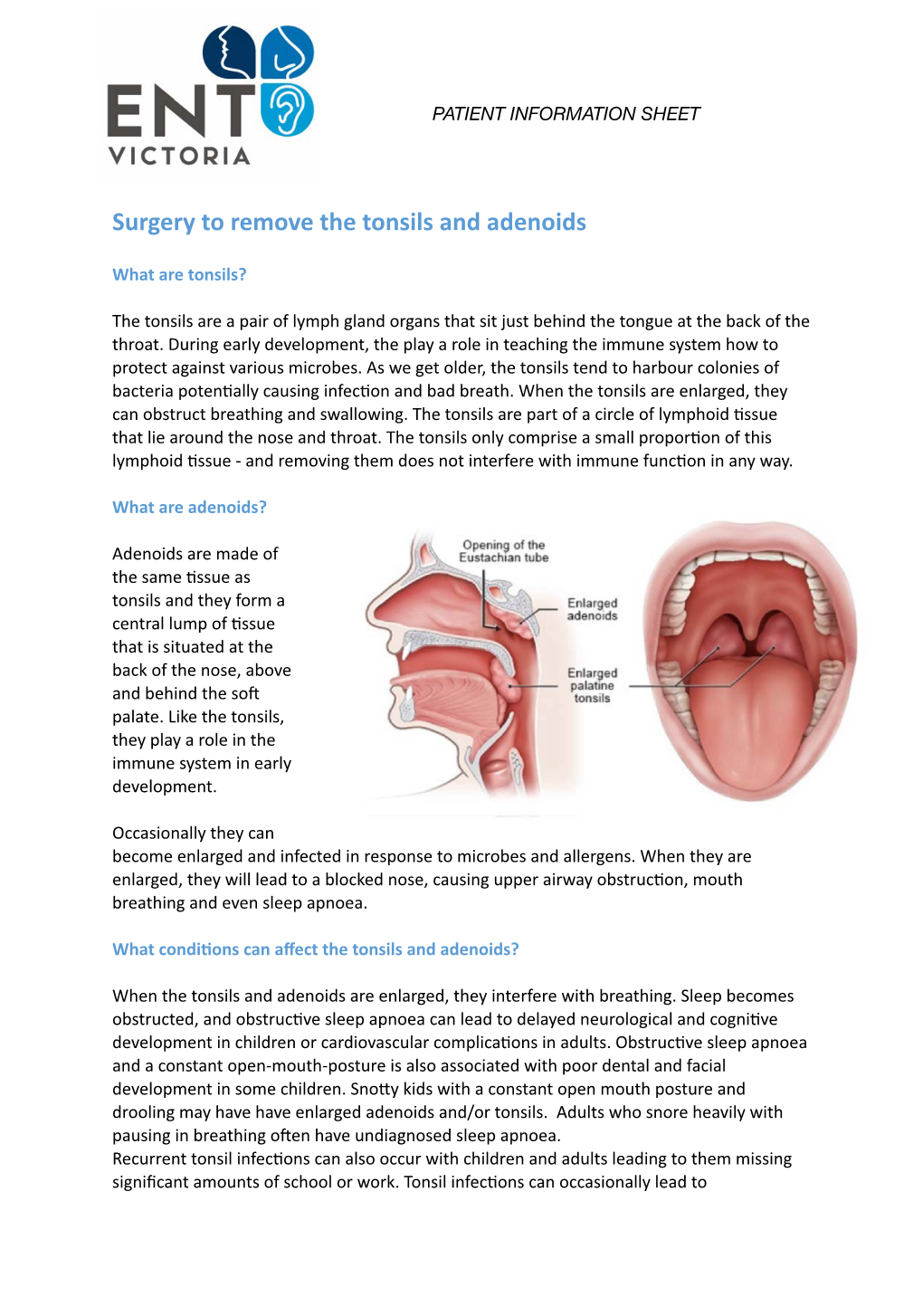 Surgery to Remove the Tonsils and Adenoids