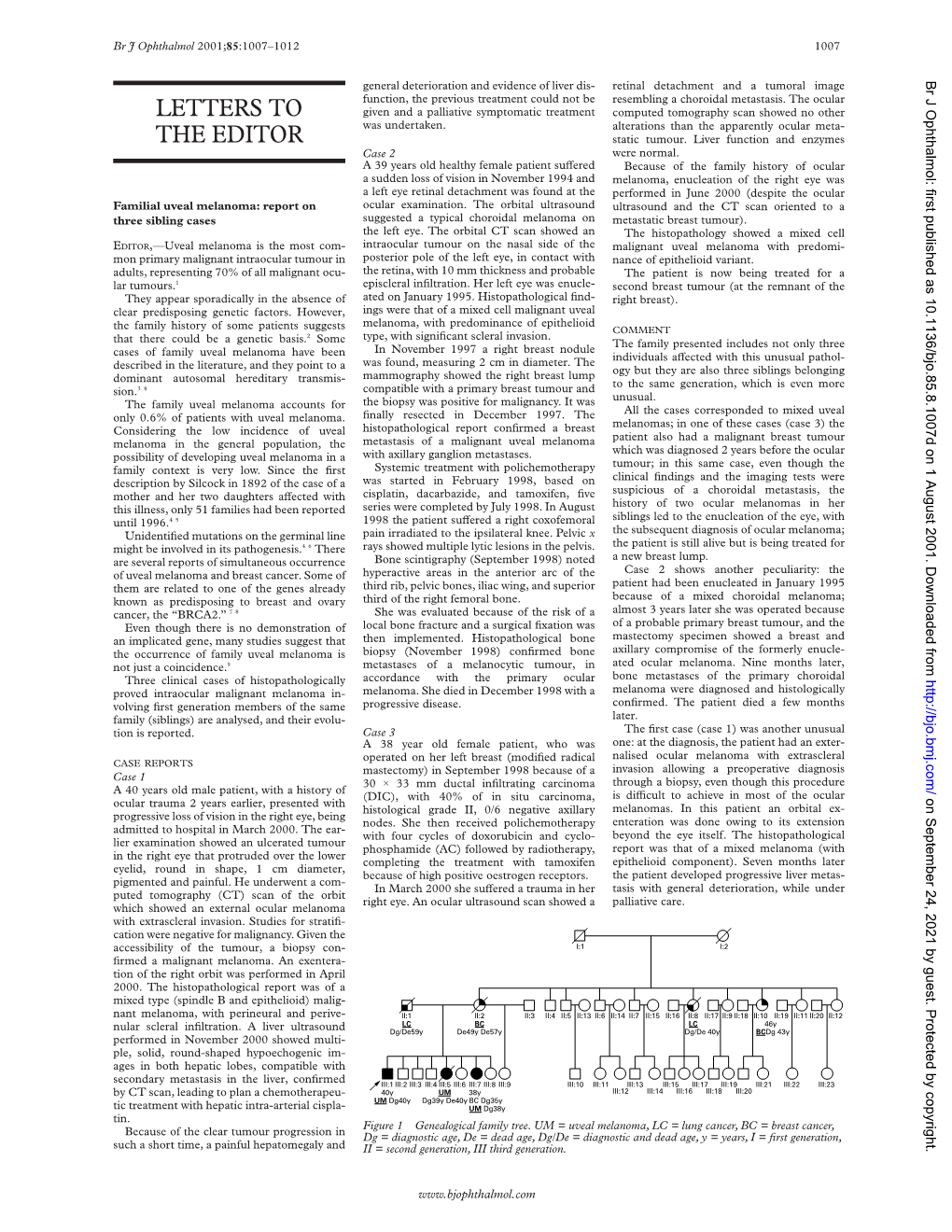 Idiopathic Polypoidal Choroidal Vasculopathy in a Patient With