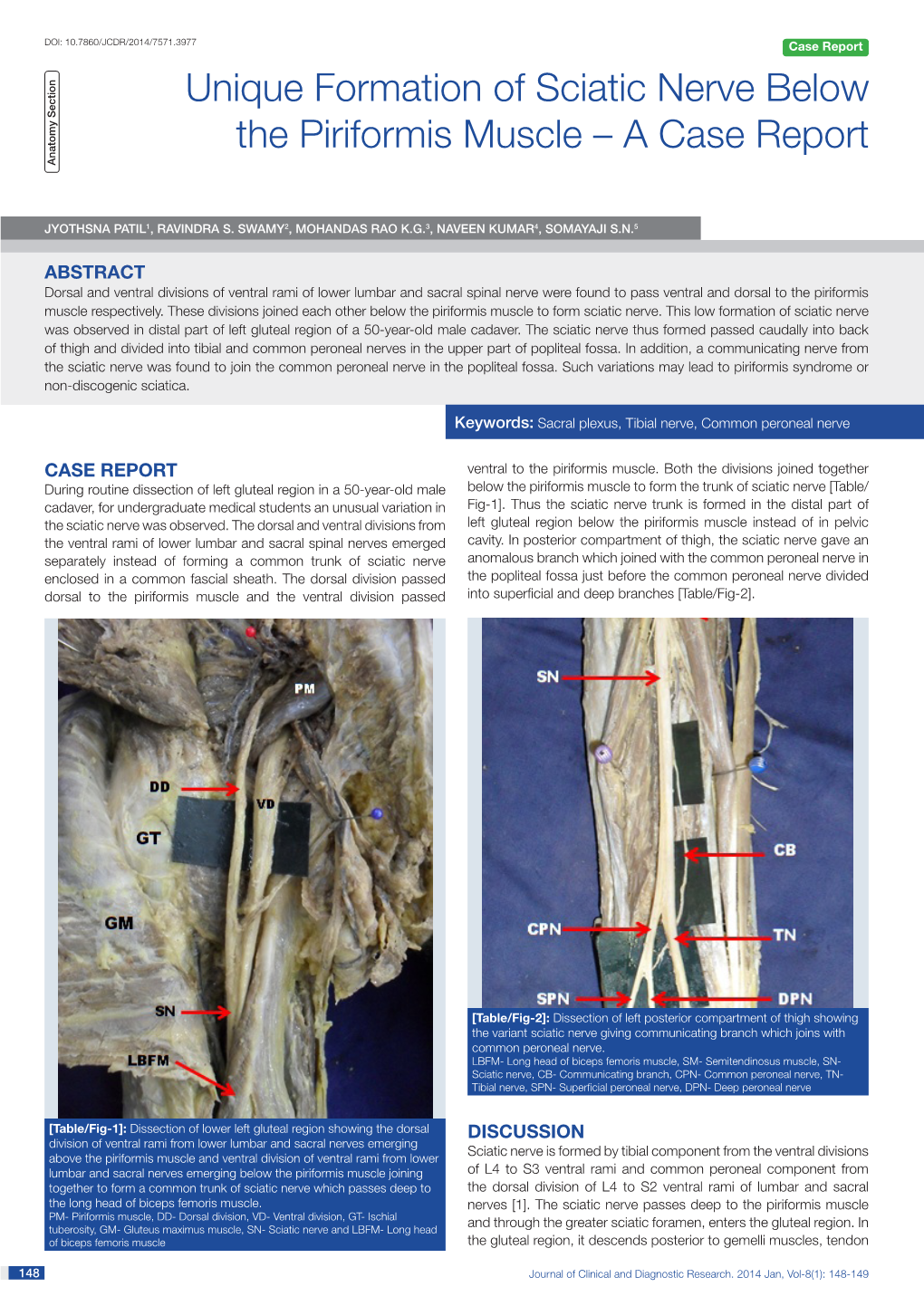 Unique Formation of Sciatic Nerve Below the Piriformis Muscle – a Case Report Anatomy Section