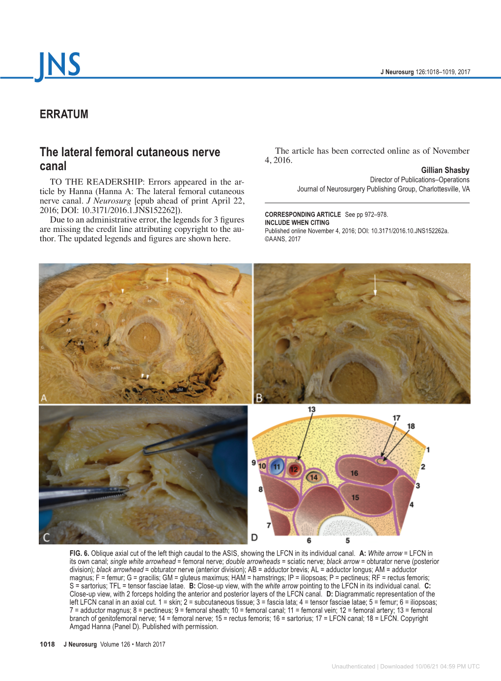 The Lateral Femoral Cutaneous Nerve Canal
