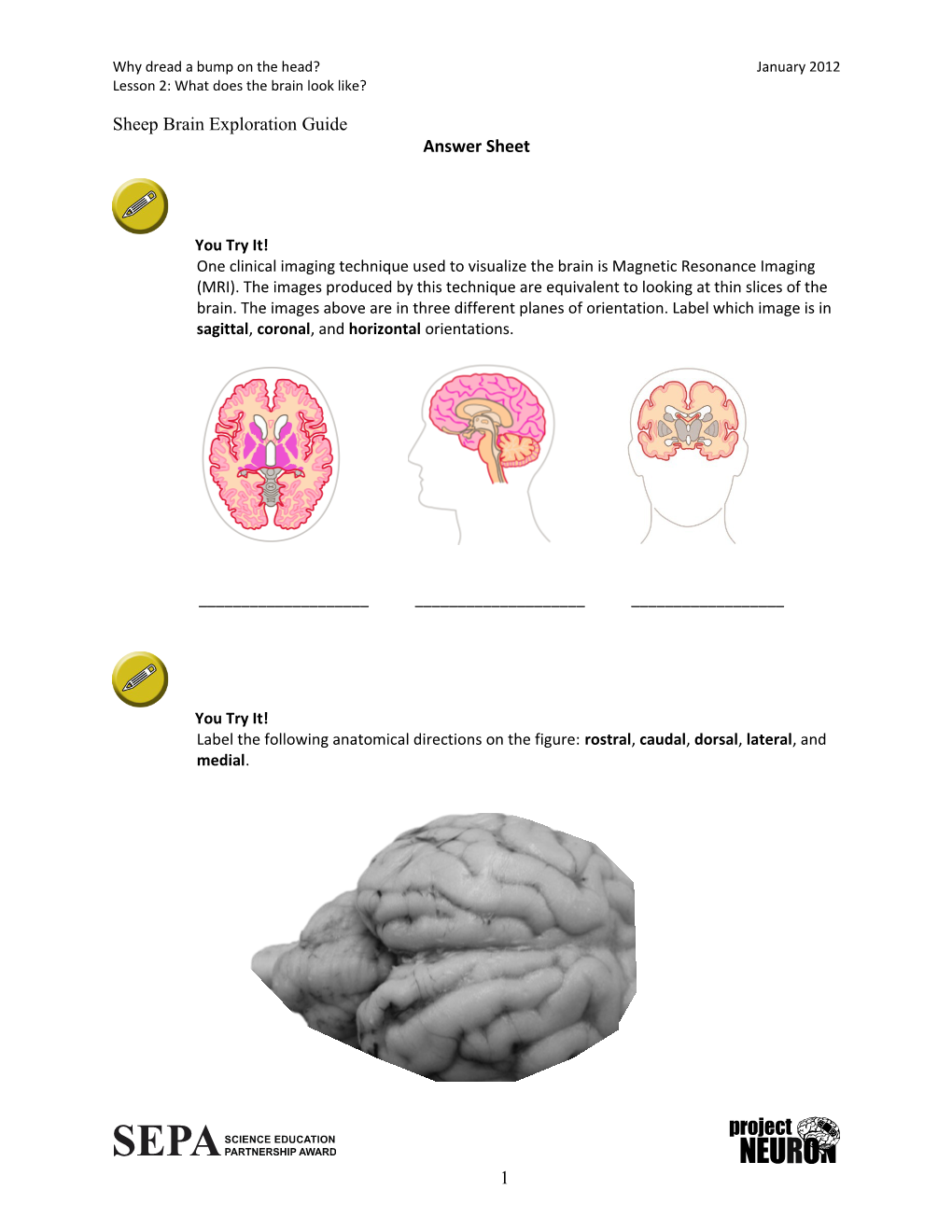 Lesson 2: What Does the Brain Look Like?