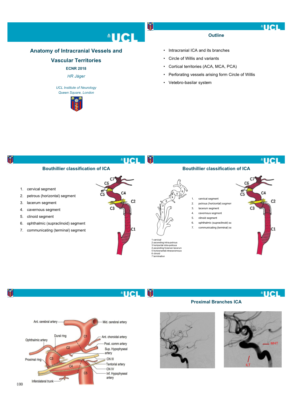 Anatomy of Intracranial Vessels and Vascular Territories