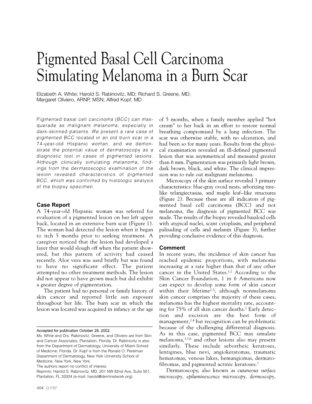 Pigmented Basal Cell Carcinoma Simulating Melanoma in a Burn Scar