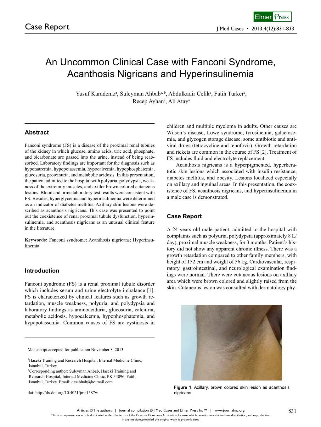 An Uncommon Clinical Case with Fanconi Syndrome, Acanthosis Nigricans and Hyperinsulinemia