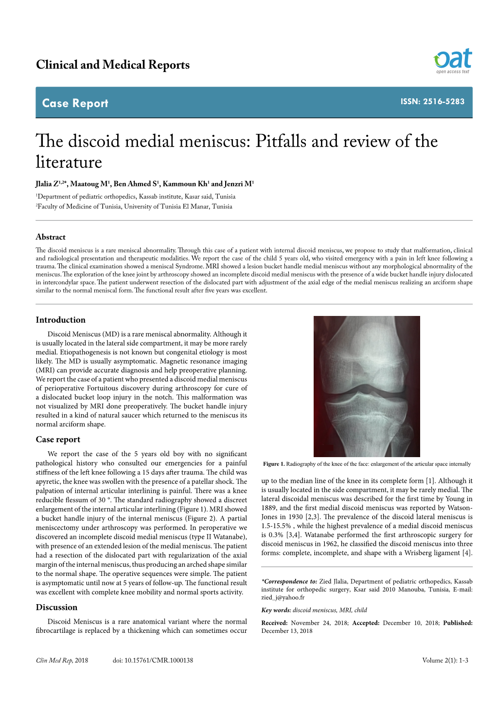 The Discoid Medial Meniscus: Pitfalls and Review of the Literature