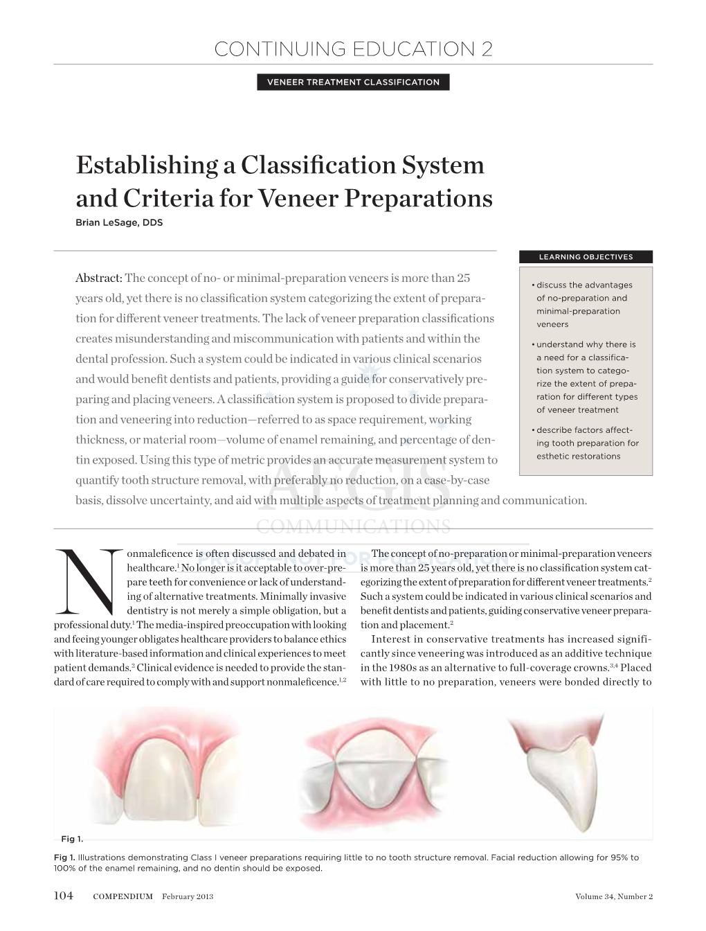 Establishing a Classification System and Criteria for Veneer Preparations Brian Lesage, DDS