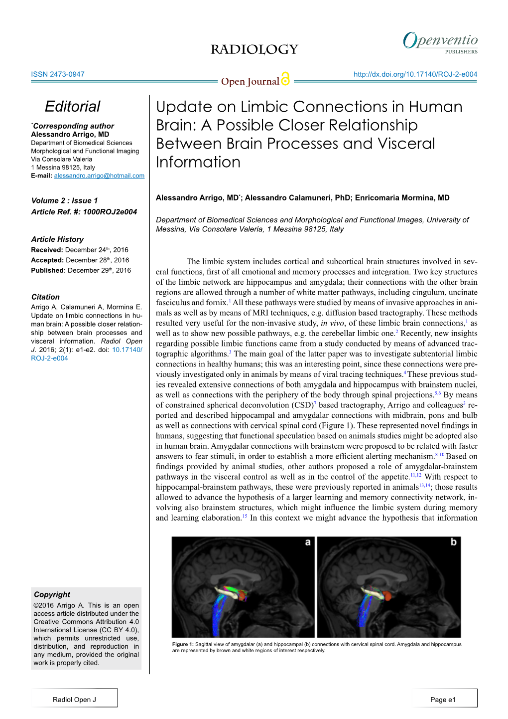 Update on Limbic Connections in Human Brain