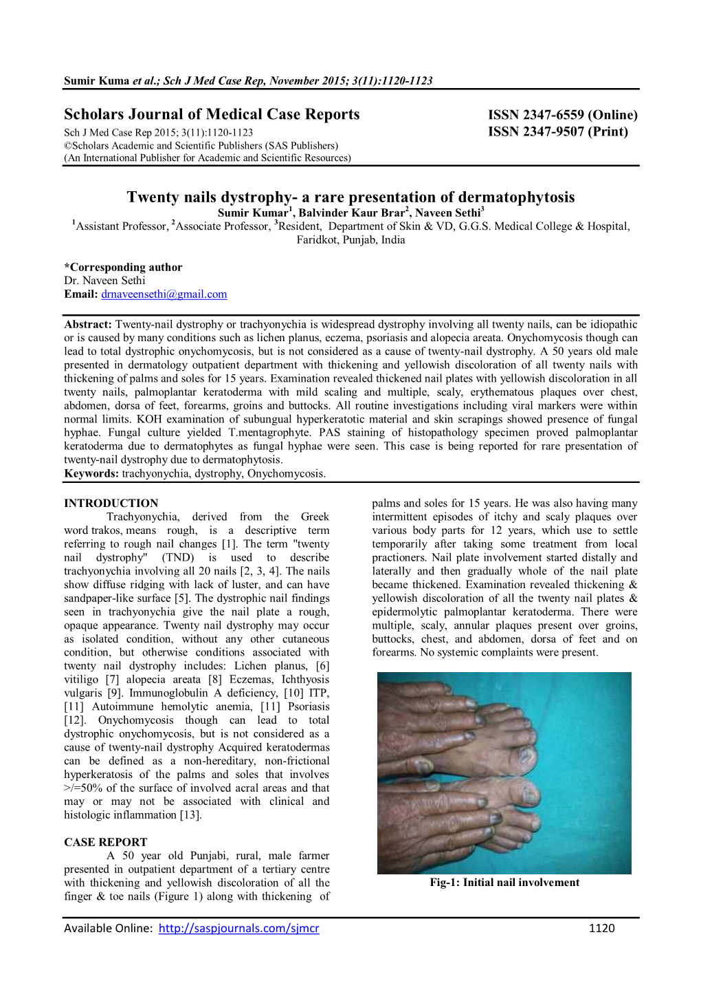 Scholars Journal of Medical Case Reports Twenty Nails Dystrophy- a Rare Presentation of Dermatophytosis