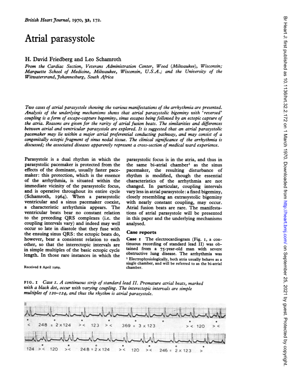 Atrial Parasystole