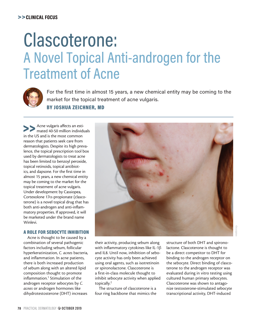 Clascoterone: a Novel Topical Anti-Androgen for the Treatment of Acne