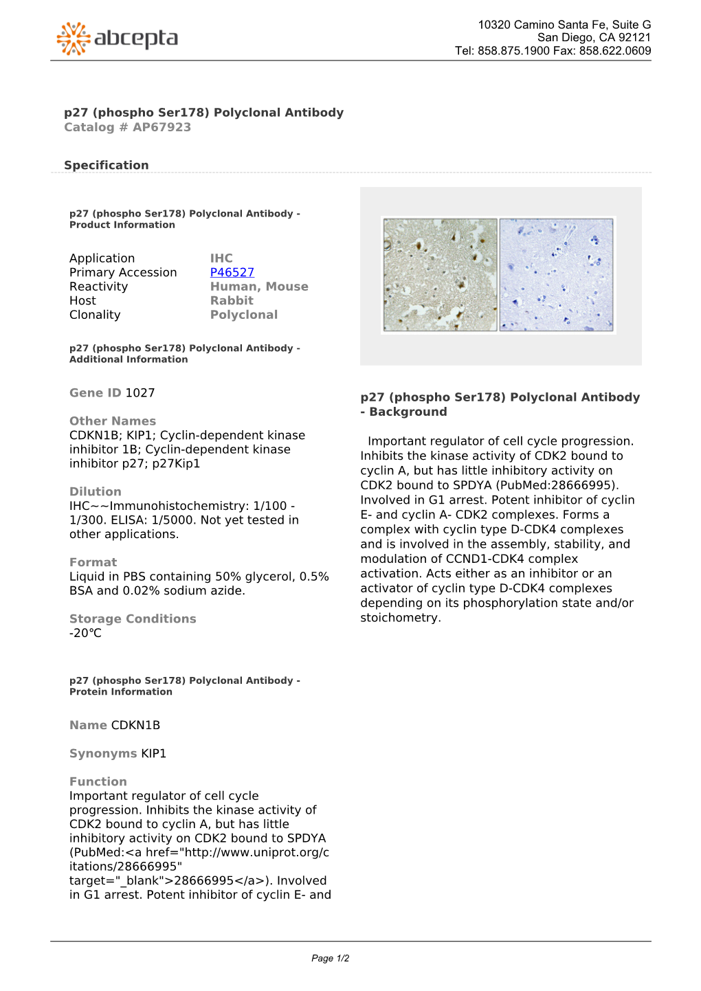 P27 (Phospho Ser178) Polyclonal Antibody Catalog # AP67923
