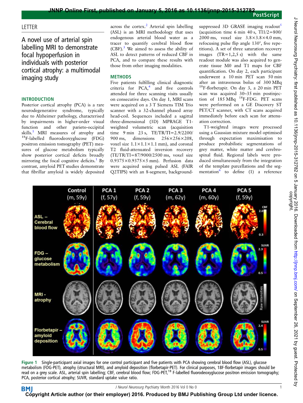 Jnnp-2015-312782.Full.Pdf