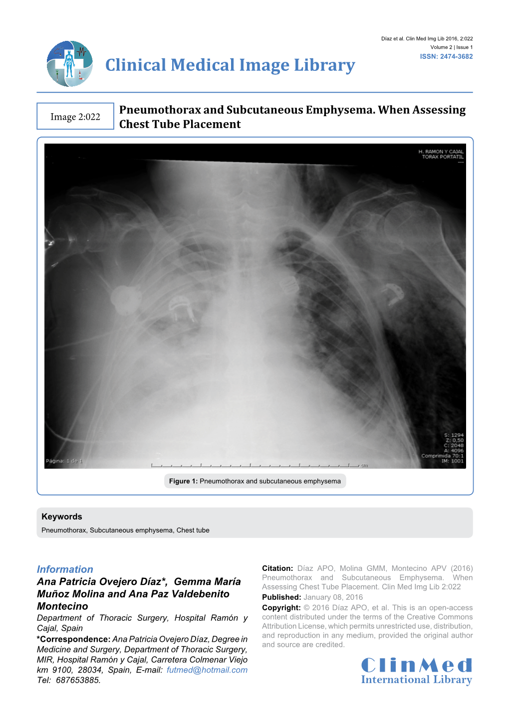 Pneumothorax and Subcutaneous Emphysema. When Assessing Image 2:022 Chest Tube Placement