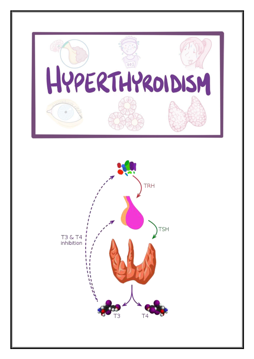 Hyperthyroidism Treatment