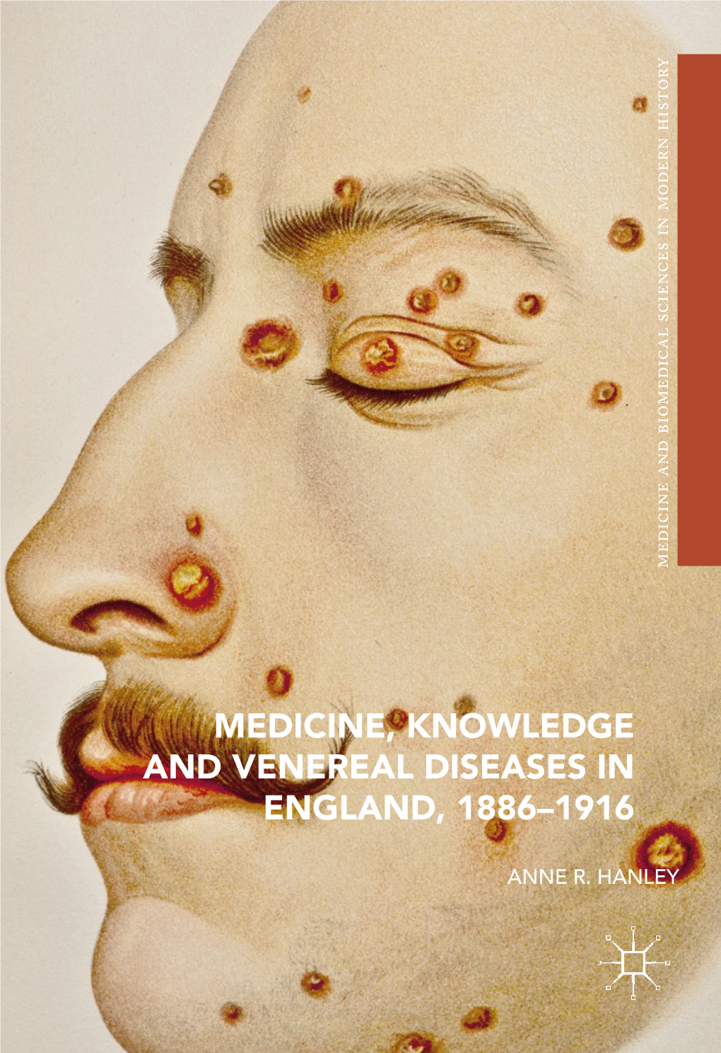 Medicine, Knowledge and Venereal Diseases in England