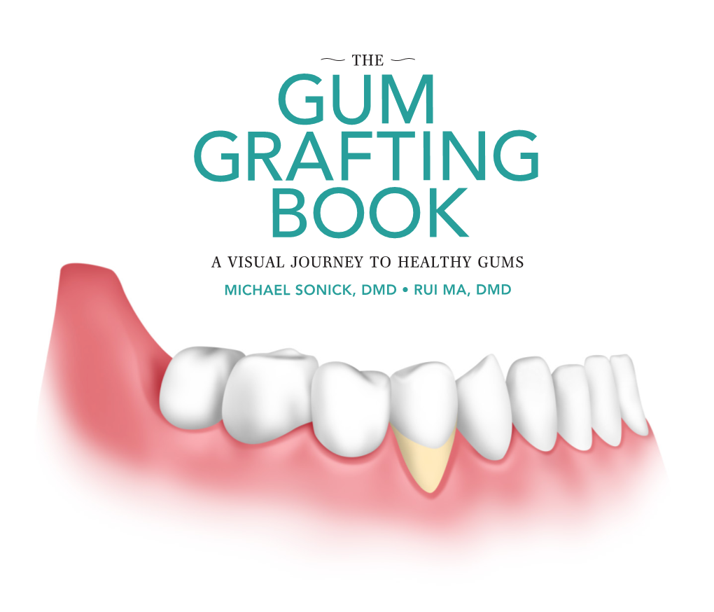 Gum Grafting Book a Visual Journey to Healthy Gums Michael Sonick, Dmd • Rui Ma, Dmd