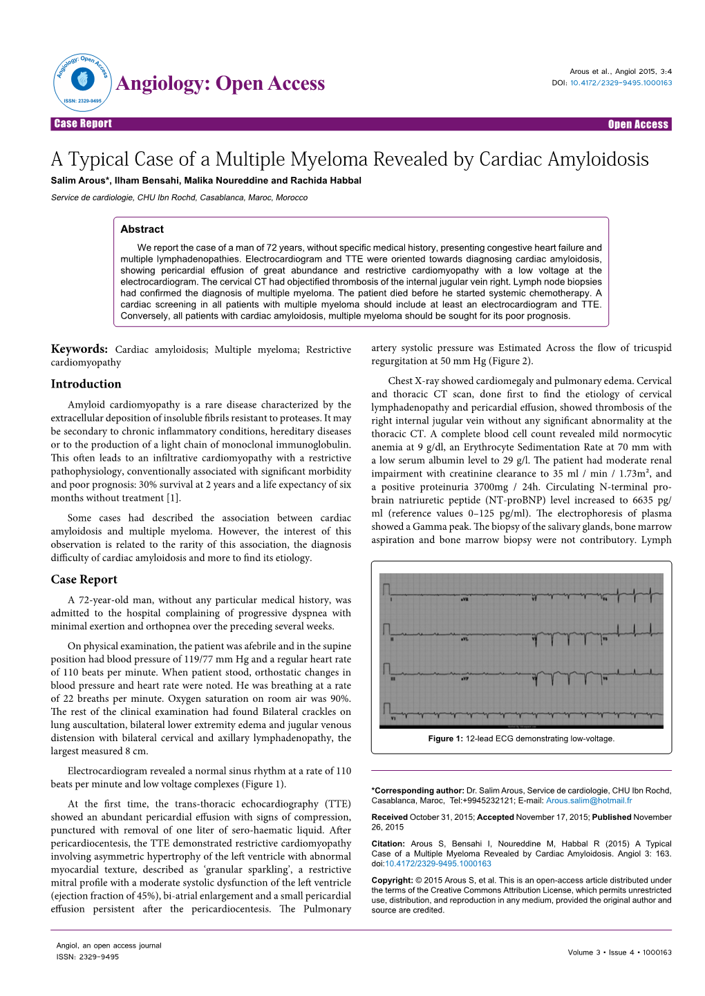 A Typical Case of a Multiple Myeloma Revealed by Cardiac Amyloidosis