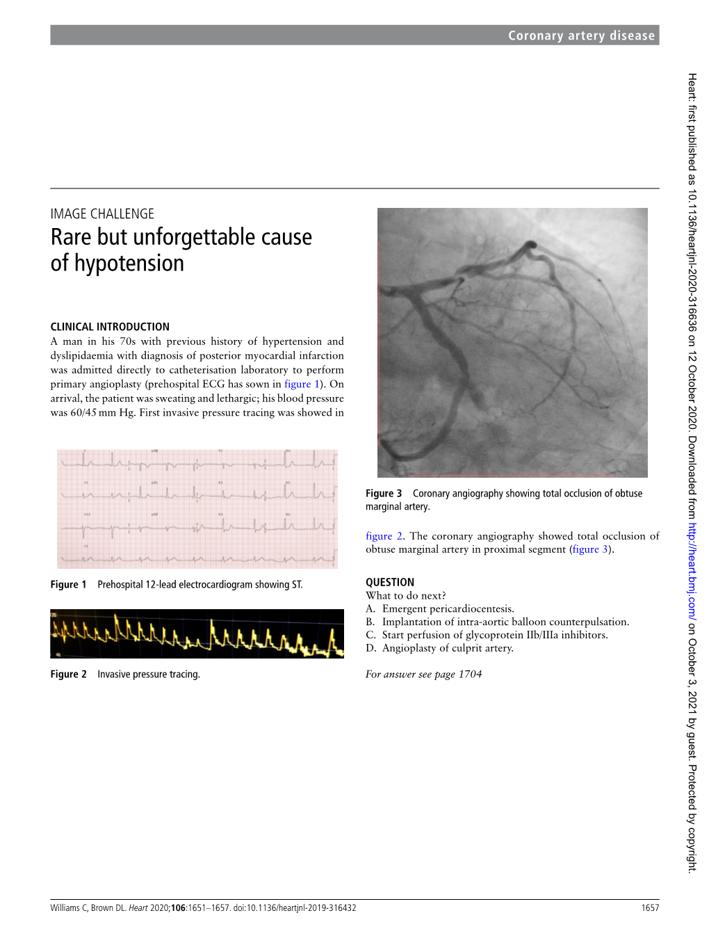 Rare but Unforgettable Cause of Hypotension