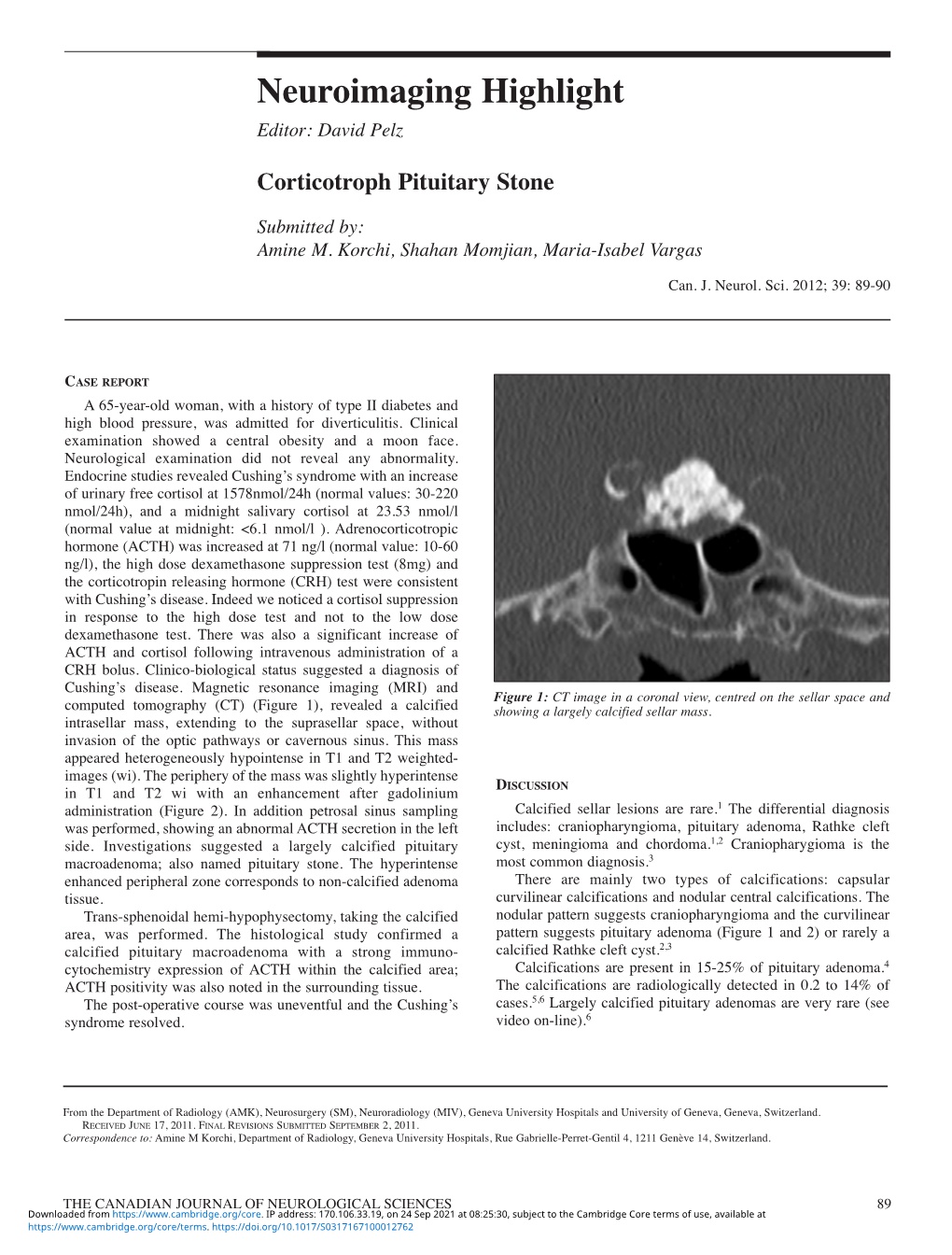 Corticotroph Pituitary Stone