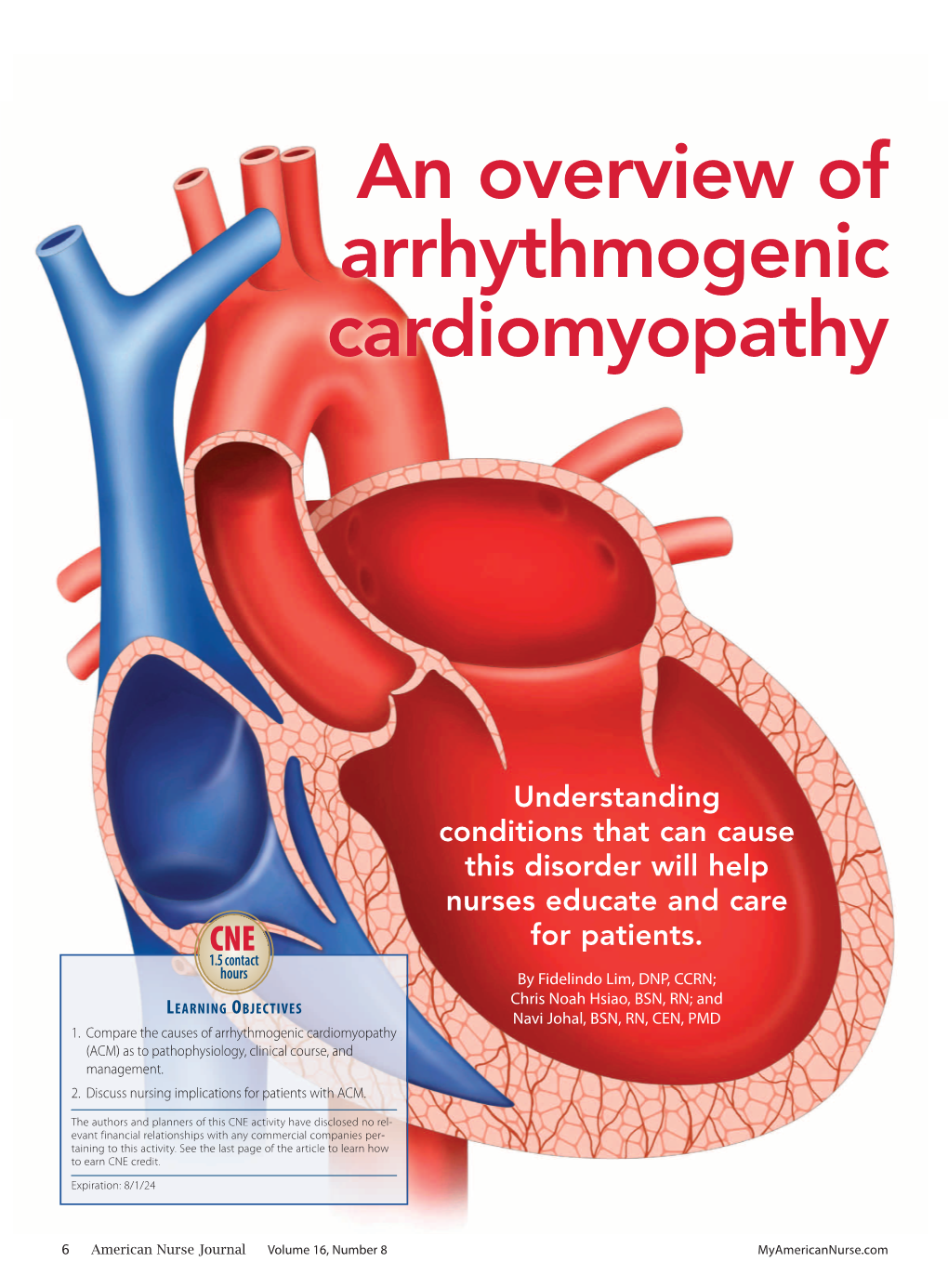 An Overview of Arrhythmogenic Cardiomyopathy