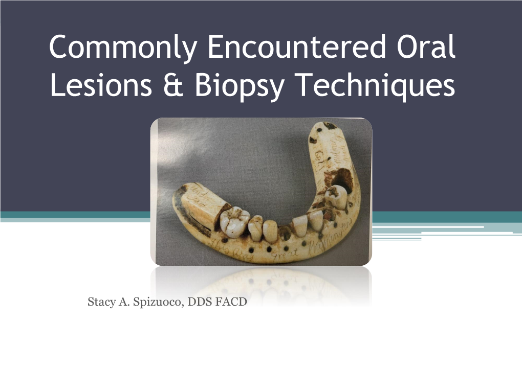 Understanding Oral Lesions