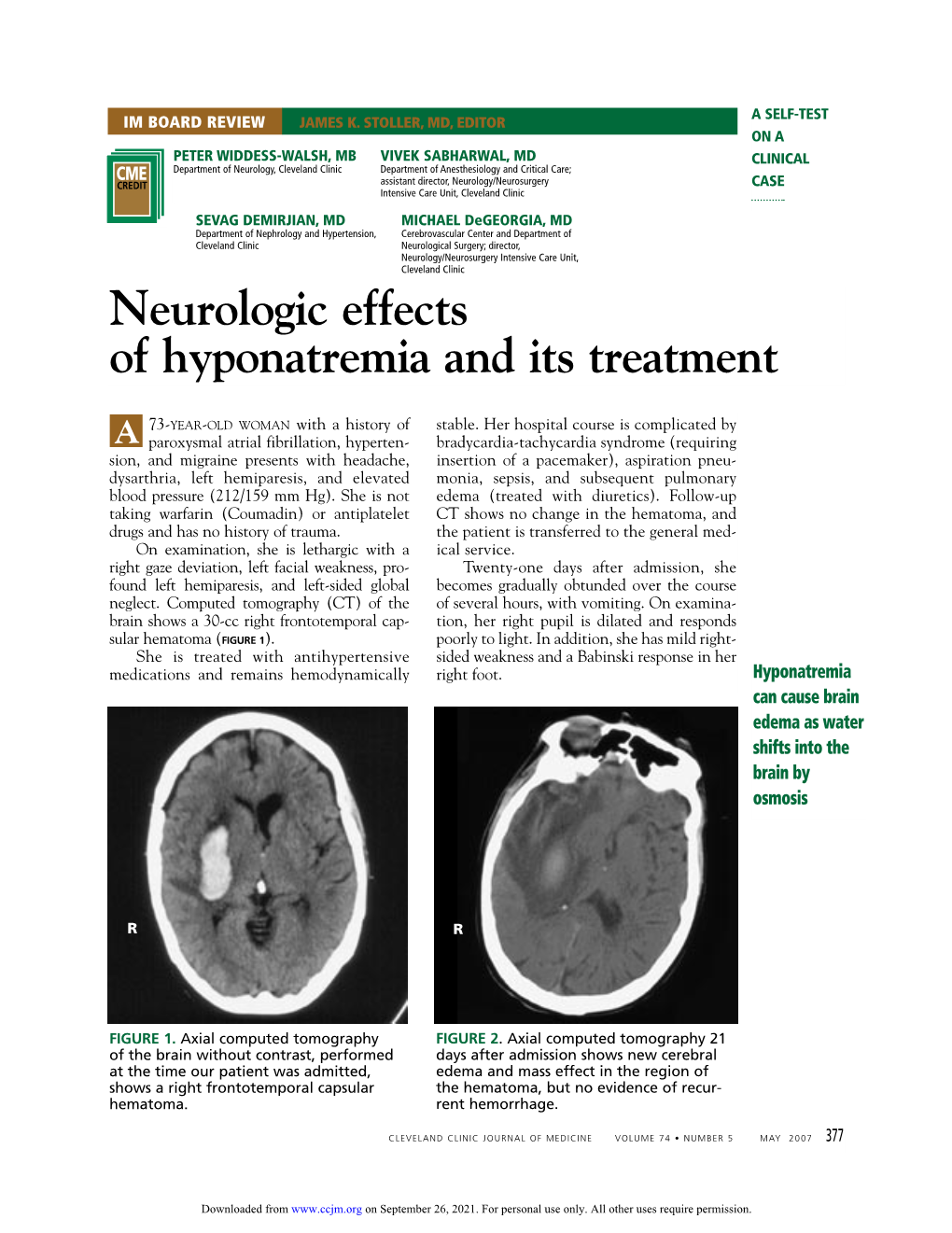 Neurologic Effects of Hyponatremia and Its Treatment
