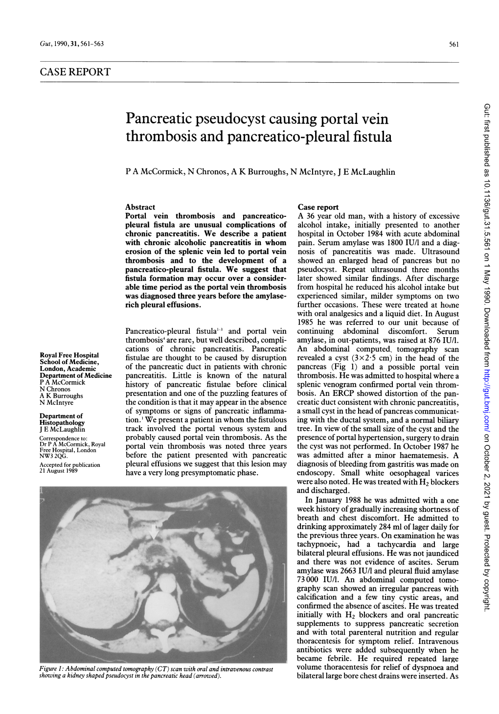 Pancreatic Pseudocyst Causing Portal Vein Thrombosis and Pancreatico-Pleural Fistula