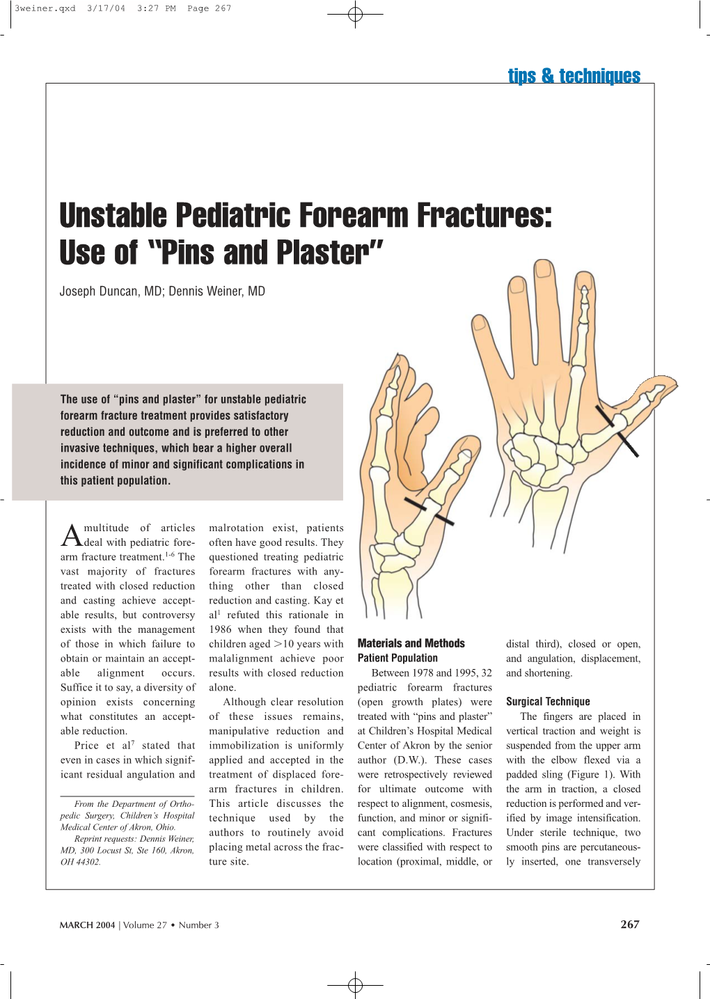 Unstable Pediatric Forearm Fractures: Use of “Pins and Plaster”