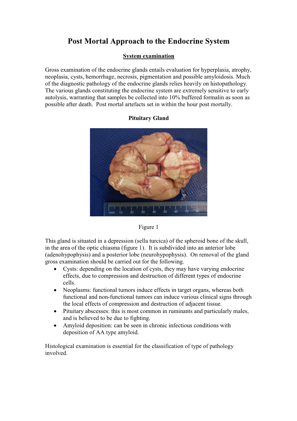 Post Mortal Approach to the Endocrine System