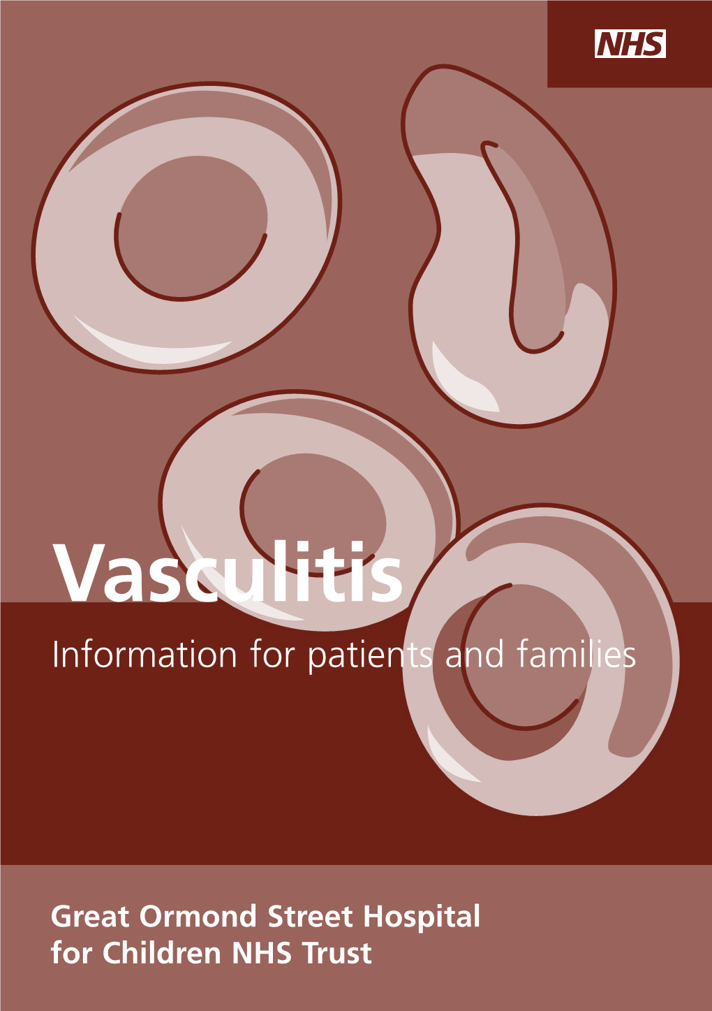 Vasculitis Information Sheet