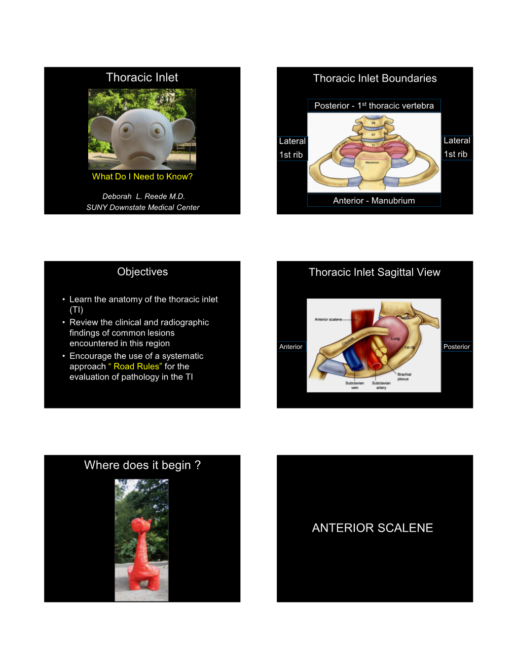 Thoracic Inlet Where Does It Begin ? ANTERIOR SCALENE