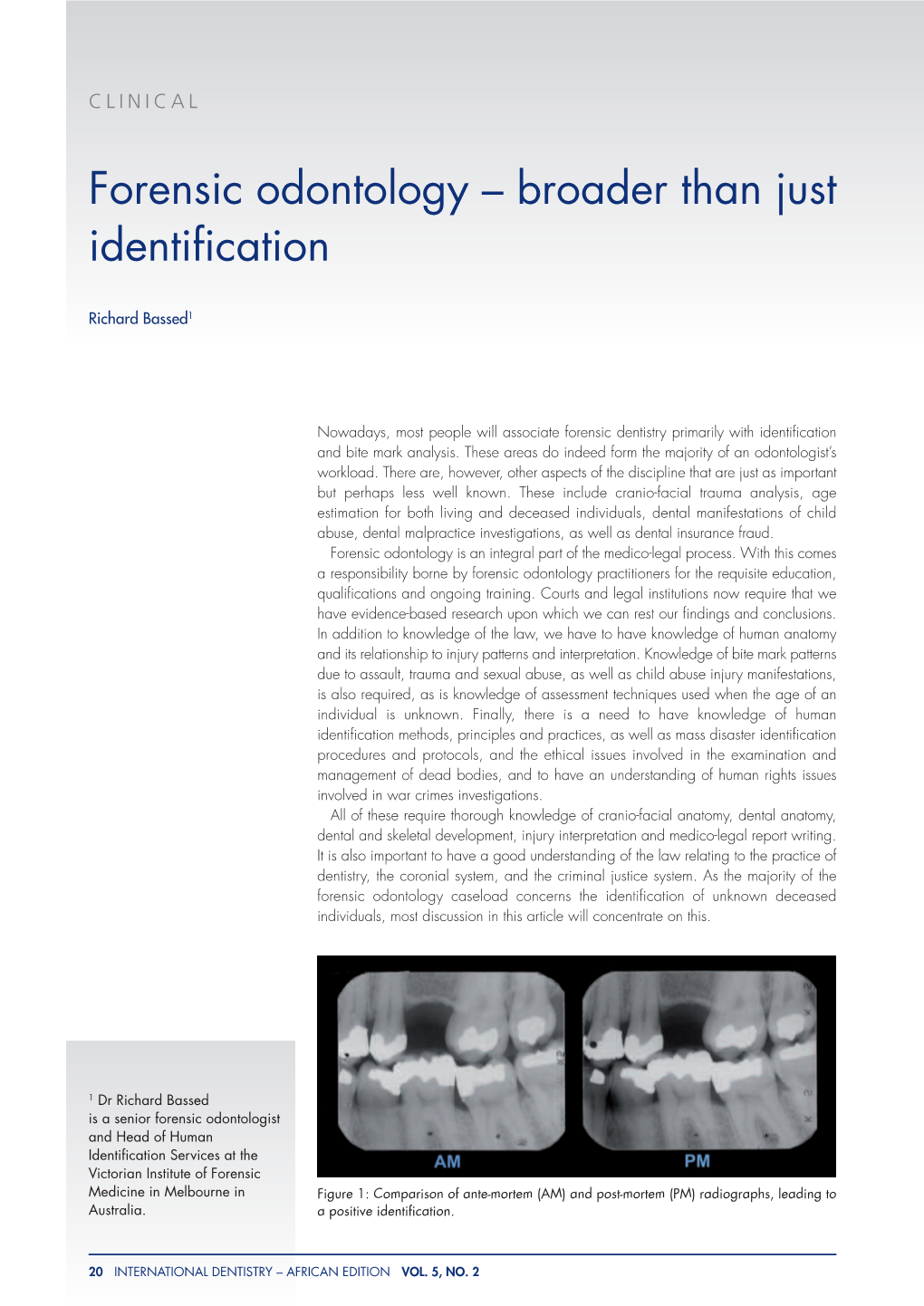 Forensic Odontology – Broader Than Just Identification