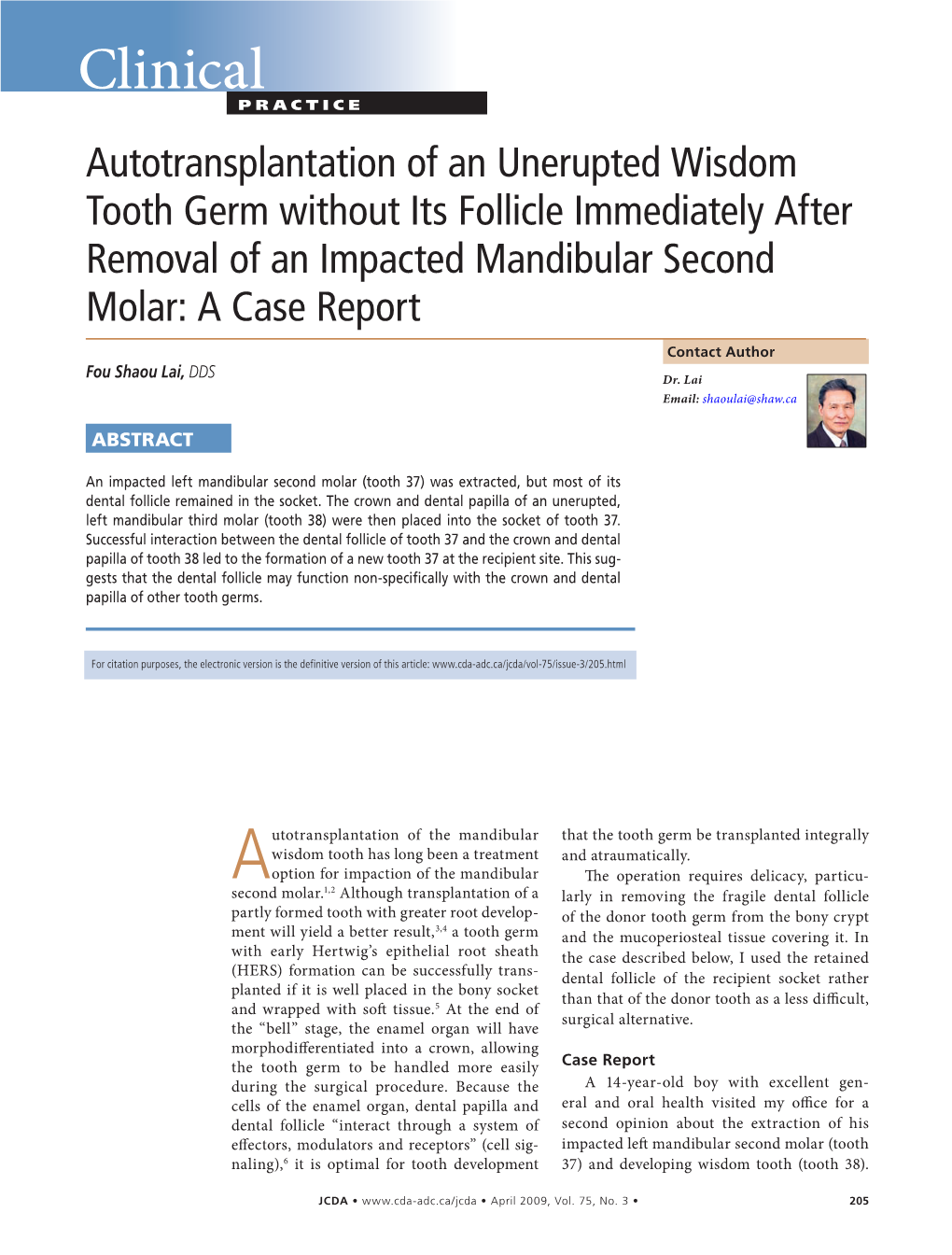 Autotransplantation of an Unerupted Wisdom Tooth Germ Without Its